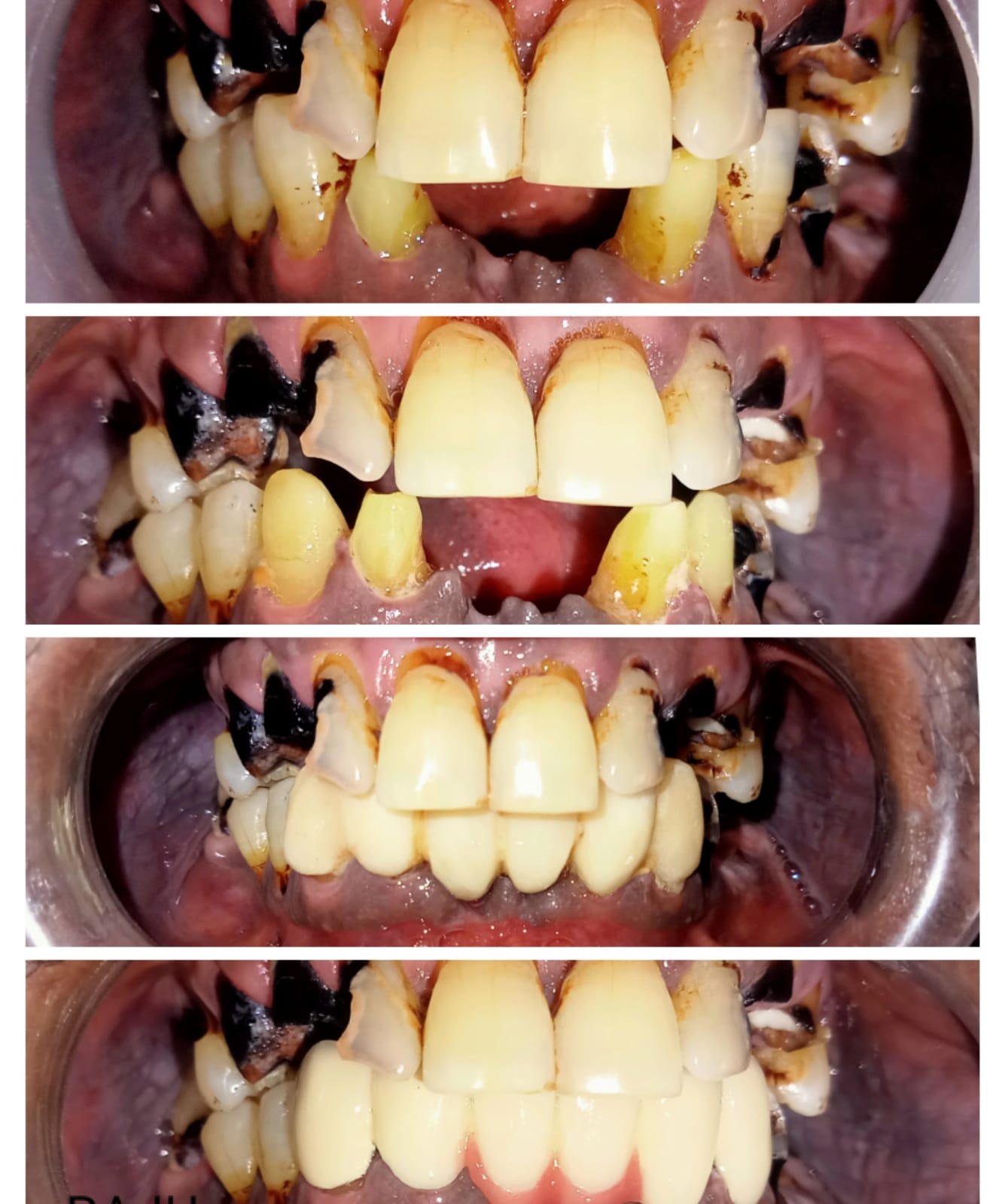 Treatment Result 1