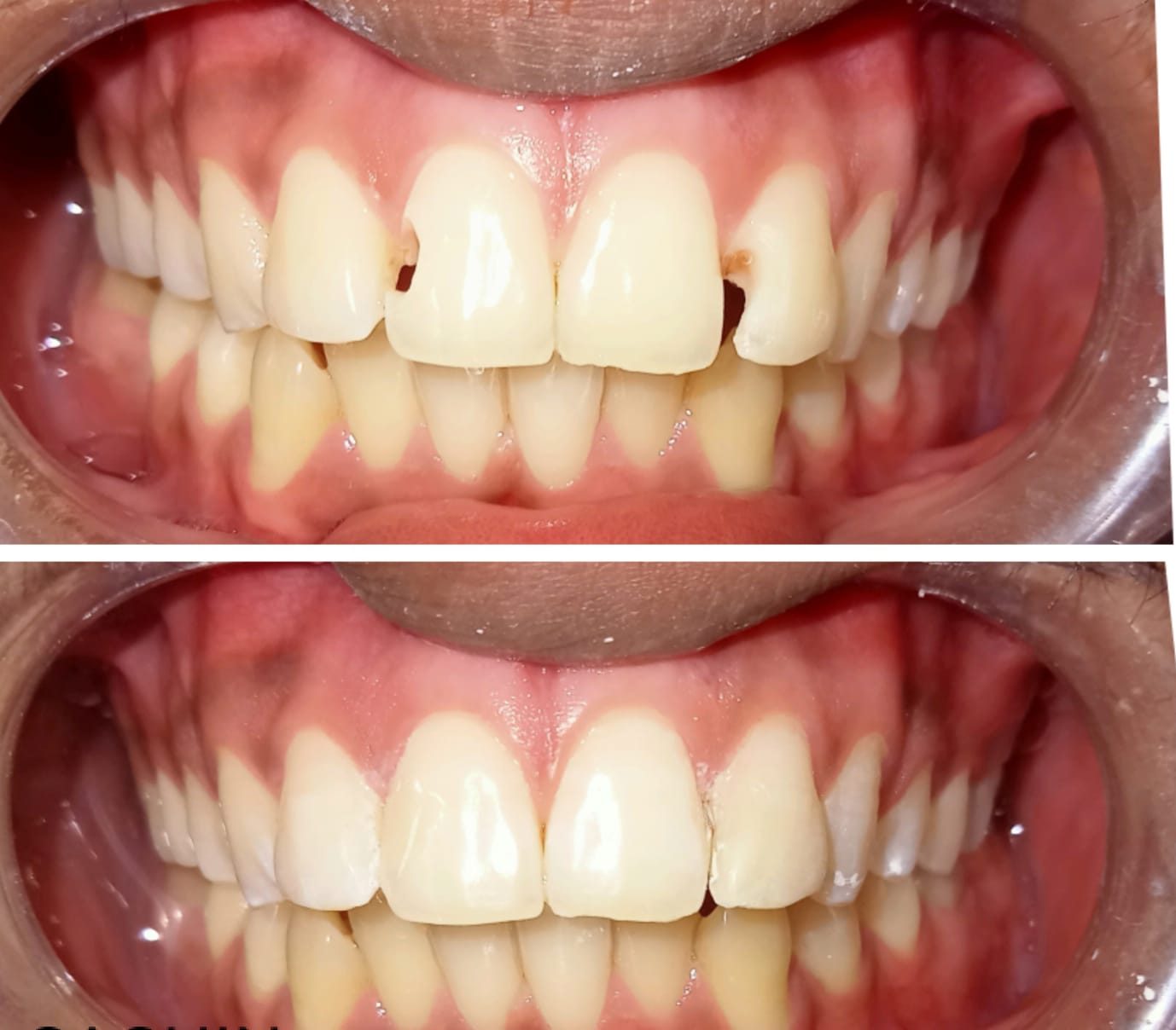 Treatment Result 2