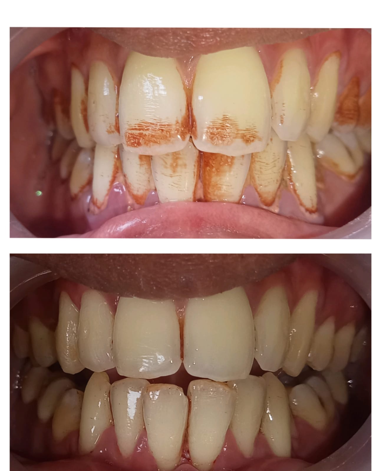 Treatment Result 3