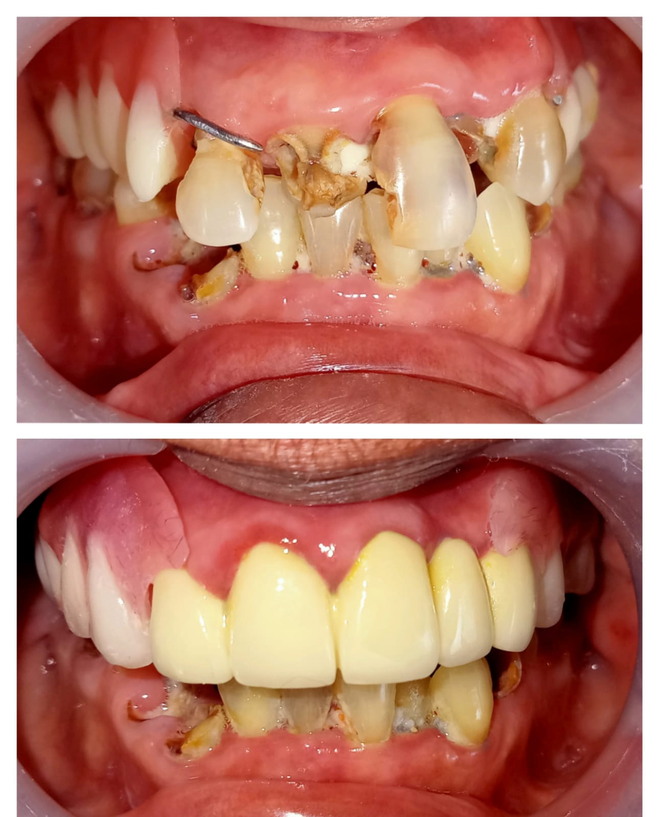 Treatment Result 4