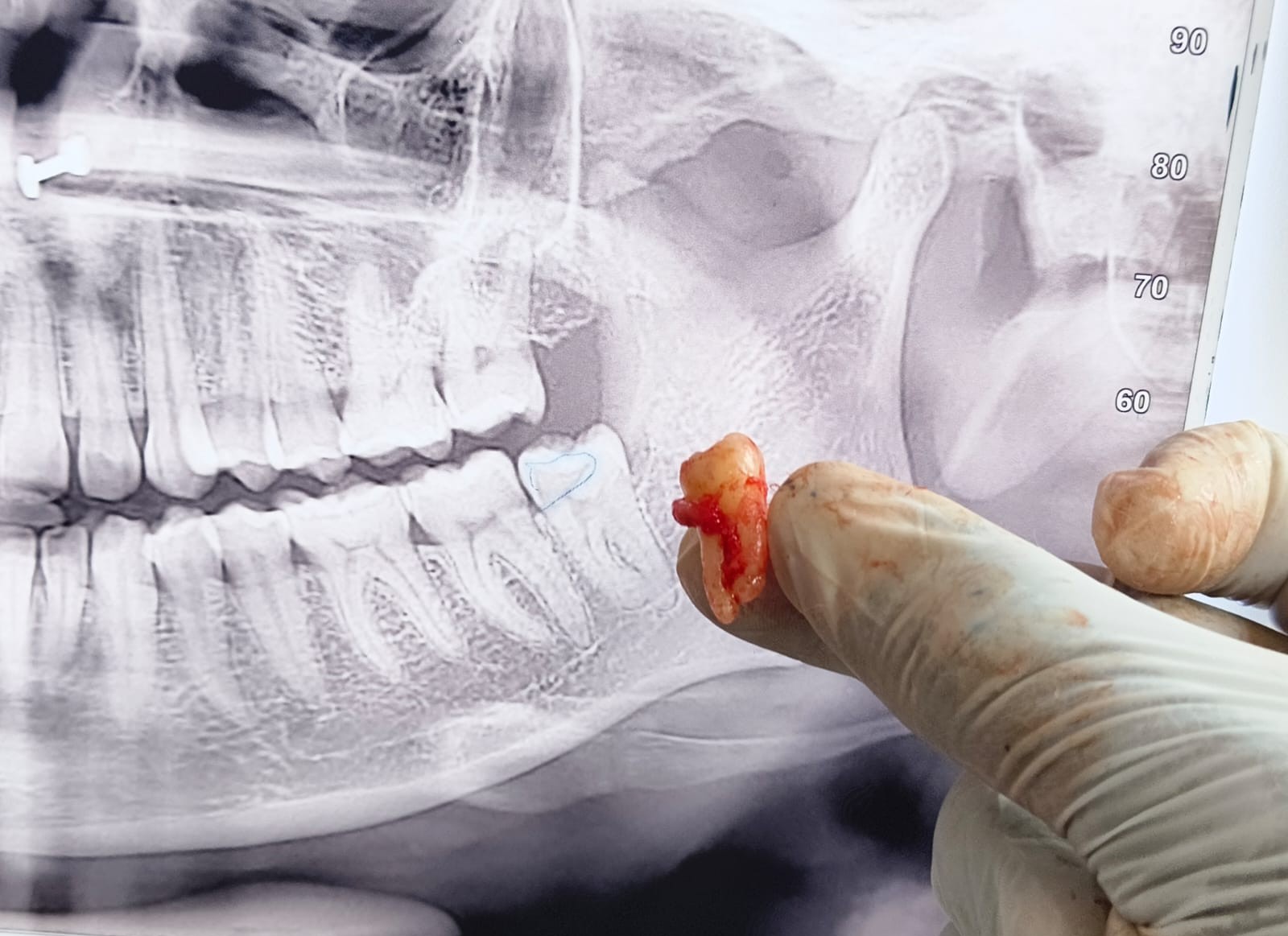 Dental Treatment - Professional teeth care